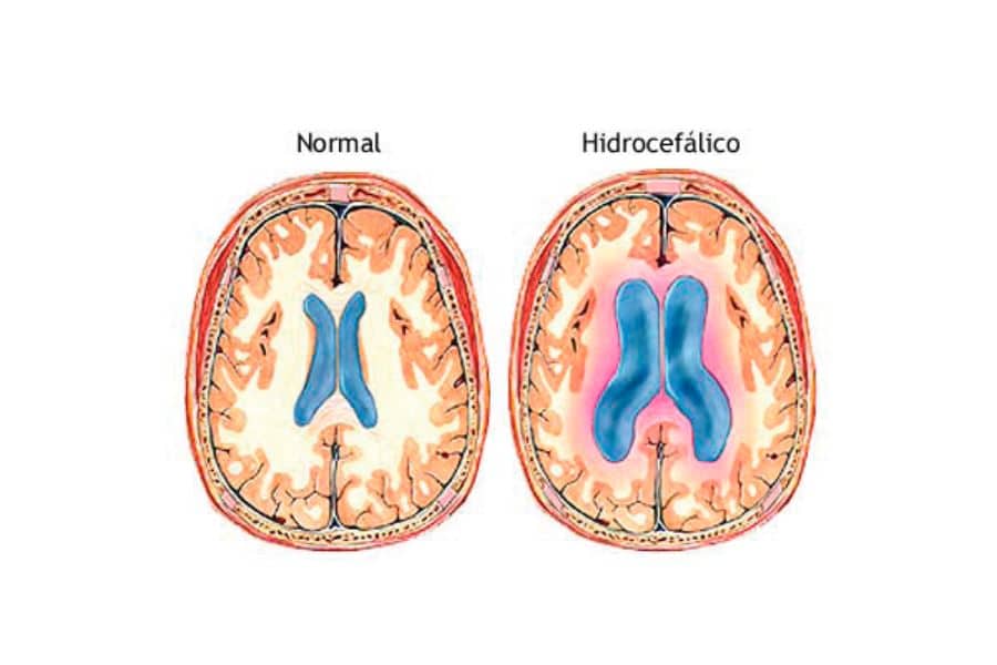 %neurocirurgiao em brasilia%