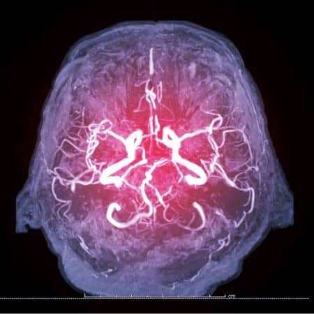 %neurocirurgiao em brasilia%
