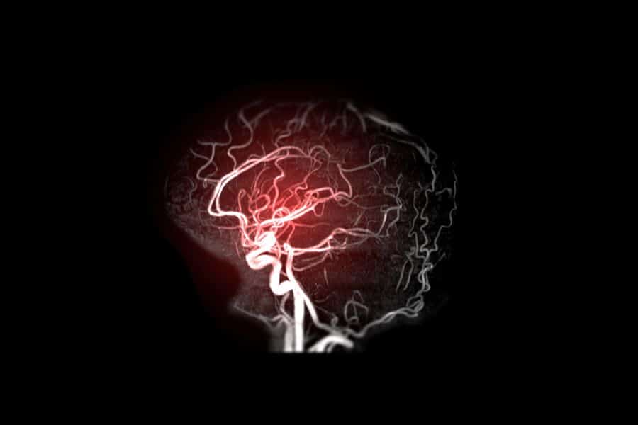 %neurocirurgiao em brasilia%