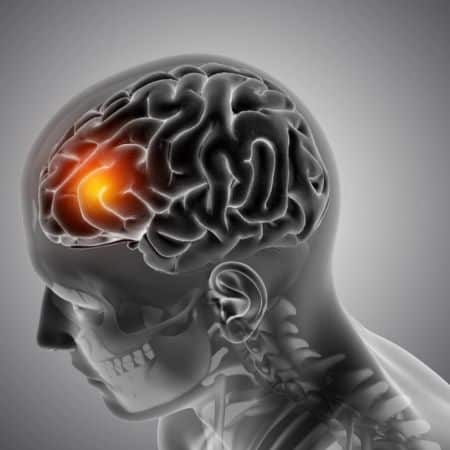 %neurocirurgiao em brasilia%